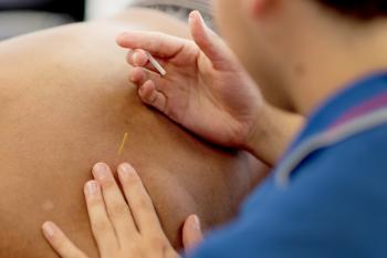 dry needling apeldoorn